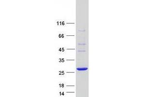 COMM Domain Containing 10 (COMMD10) protein (Myc-DYKDDDDK Tag)