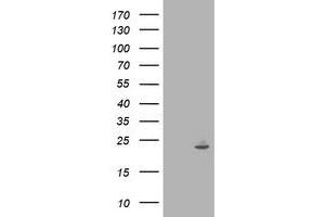 Western Blotting (WB) image for anti-Interferon-Induced Protein 35 (IFI35) antibody (ABIN1498799) (IFI35 Antikörper)