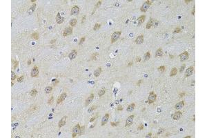 Immunohistochemistry of paraffin-embedded mouse brain using  Antibody (ABIN3022786, ABIN3022787, ABIN3022788 and ABIN6219229) at dilution of 1:100 (40x lens). (ADRBK2 Antikörper  (AA 1-300))