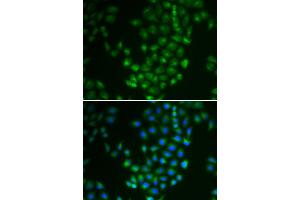 Immunofluorescence (IF) image for anti-Protein Kinase, CAMP Dependent, Catalytic, beta (PRKACB) antibody (ABIN1876512) (PRKACB Antikörper)