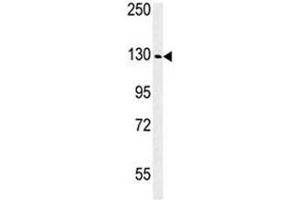 Western Blotting (WB) image for anti-Insulin-Like Growth Factor 1 Receptor (IGF1R) (AA 51-77) antibody (ABIN3031345)
