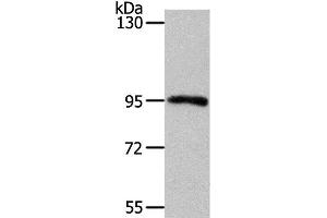 Western Blot analysis of Mouse kidney tissue using MYSM1 Polyclonal Antibody at dilution of 1:1100 (MYSM1 Antikörper)