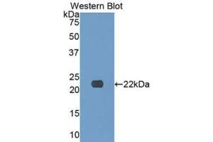Detection of Recombinant COL17, Human using Polyclonal Antibody to Collagen Type XVII (COL17) (COL17 Antikörper  (AA 184-375))