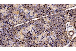 Immunohistochemistry (IHC) image for anti-Prolactin Receptor (PRLR) (AA 20-229) antibody (ABIN7437362)