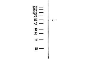 Western blot analysis of lysates from COLO205 cells(heat-shock,45 min treatment), using PRM Antibody at 1/1000 dilution.
