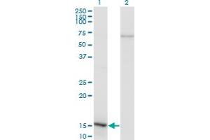 Western Blot analysis of NFATC2IP expression in transfected 293T cell line by NFATC2IP monoclonal antibody (M02), clone 3E9-B7. (NFATC2IP Antikörper  (AA 1-138))