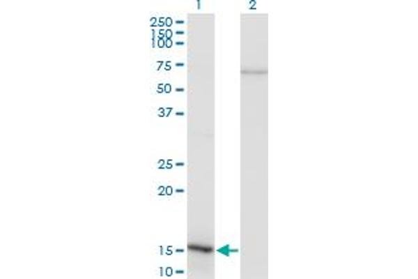 NFATC2IP anticorps  (AA 1-138)