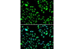 Immunofluorescence analysis of MCF7 cell using L3MBTL3 antibody. (L3MBTL3 Antikörper)