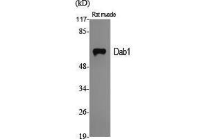 Western Blot (WB) analysis of specific cells using Dab1 Polyclonal Antibody. (DAB1 Antikörper  (Ser296))
