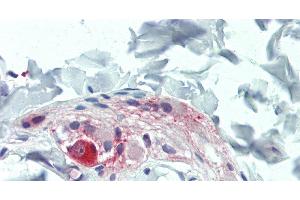 Immunohistochemistry of paraffin-embedded Colon, Submucosal Plexus tissue using TAC1 Polyclonal Antibody at dilution of 1:100. (TAC1 Antikörper)