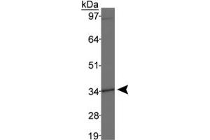 Western blot analysis of DLX4 in MDA-MB-231 cell lysates using DLX4 polyclonal antibody . (DLX4 Antikörper  (AA 1-60))
