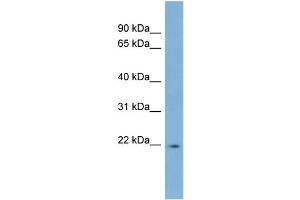 WB Suggested Anti-LBX2 Antibody Titration:  0.