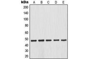 Western blot analysis of IKK beta (pS23) expression in HEK293T LPS-treated (A), SP2/0 LPS-treated (B), PC12 LPS-treated (C), HT29 (D), NIH3T3 TNFa-treated (E) whole cell lysates. (IKBKB Antikörper  (N-Term, pSer23))