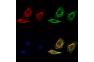 ABIN7094885 and ABIN7098938 staining Hela cells by IF/ICC.