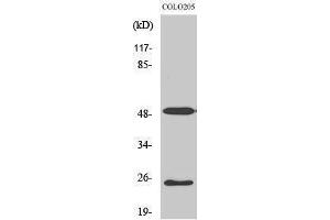 Western Blotting (WB) image for anti-Lecithin Retinol Acyltransferase (Phosphatidylcholine--Retinol O-Acyltransferase) (LRAT) (Internal Region) antibody (ABIN3185408) (LRAT Antikörper  (Internal Region))
