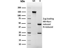 SDS-PAGE Analysis Purified Involucrin Mouse Recombinant Monoclonal Antibody (rIVRN/827).