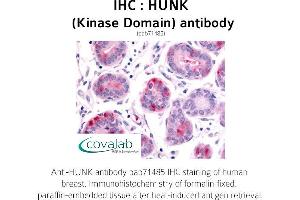Image no. 1 for anti-Hormonally Up-Regulated Neu-Associated Kinase (HUNK) antibody (ABIN1735637) (HUNK Antikörper)