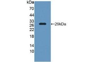 Detection of Recombinant LCP1, Human using Polyclonal Antibody to L-Plastin (LCP1) (LCP1 Antikörper  (AA 5-233))