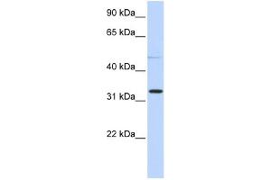WB Suggested Anti-NEU4 Antibody Titration: 0. (Sialidase 4 Antikörper  (N-Term))