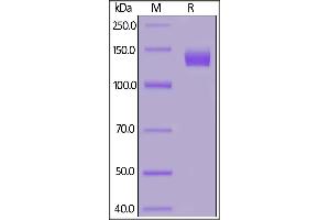 Human ACE2, Fc Tag (MALS verified) on SDS-PAGE under reducing (R) condition. (ACE2 Protein (Fc Tag))