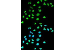 Immunofluorescence analysis of HeLa cell using MSH6 antibody. (MSH6 Antikörper  (AA 1-290))