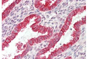 Rabbit Anti-KRT19 antibody  Formalin Fixed Paraffin Embedded Tissue: Human Uterus Primary antibody Concentration: 1:100 Secondary Antibody: Donkey anti-Rabbit-Cy3 Secondary Antibody Concentration: 1:200 Magnification: 20x Exposure Time: 0. (Cytokeratin 19 Antikörper  (N-Term))