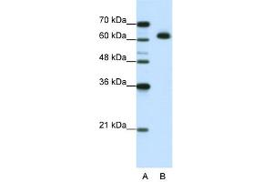 WB Suggested Anti-MGC42174 Antibody Titration:  1. (DIS3L2 Antikörper  (N-Term))
