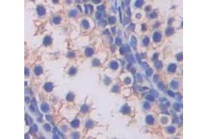 IHC-P analysis of Human Tissue, with DAB staining. (SLC2A14 Antikörper  (AA 51-105))