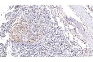 Detection of CD23 in Human Tonsil Tissue using Polyclonal Antibody to Cluster Of Differentiation 23 (CD23) (FCER2 Antikörper  (AA 151-321))