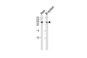 Western blot analysis of lysates from Hela cell line mouse spleen tissue lysate(from left to right), using TCF21 Antibody at 1:1000 at each lane. (TCF21 Antikörper  (C-Term))