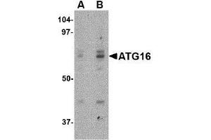 Western blot analysis of ATG16 in HeLa cell lysate with this product atG16 antibody at (A) 0. (ATG16L1 Antikörper  (Center))
