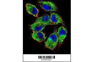 Confocal immunofluorescent analysis of NKD2 Antibody with A375 cell followed by Alexa Fluor 488-conjugated goat anti-rabbit lgG (green). (NKD2 Antikörper  (C-Term))