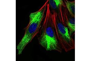 Immunofluorescence (IF) image for anti-Zinc Finger E-Box Binding Homeobox 1 (ZEB1) (AA 967-1108) antibody (ABIN1724885)
