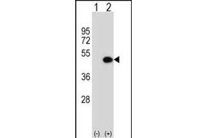 Western Blotting (WB) image for anti-Integrin-Linked Kinase-Associated Serine/threonine Phosphatase 2C (ILKAP) (AA 243-270) antibody (ABIN652065)
