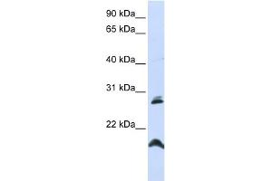 WB Suggested Anti-SPATA9 Antibody Titration:  0. (SPATA9 Antikörper  (N-Term))