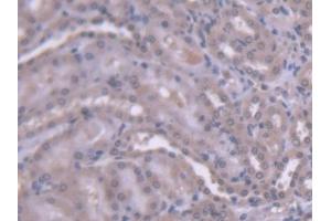 DAB staining on IHC-P; Samples: Rat Kidney Tissue (HEXB Antikörper  (AA 100-216))