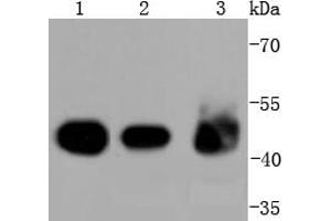 Lane 1: A431 Cell lysates, Lane 2: Mouse colon lysates, Lane 3: Mouse kidney lysates, probed with Cytokeratin 18 (1F11) Monoclonal Antibody  at 1:2000 overnight at 4˚C. (Cytokeratin 18 Antikörper)