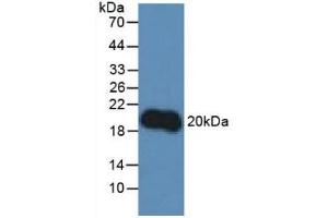 Detection of IL10 in Rat Lymphocytes Cells using Polyclonal Antibody to Interleukin 10 (IL10) (IL-10 Antikörper  (AA 19-178))
