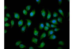 Immunofluorescence (IF) image for anti-HECT, C2 and WW Domain Containing E3 Ubiquitin Protein Ligase 2 (HECW2) (AA 495-641) antibody (ABIN7151037)