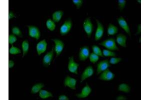 Immunofluorescence staining of A549 cells with ABIN7151037 at 1:166, counter-stained with DAPI. (HECW2 Antikörper  (AA 495-641))