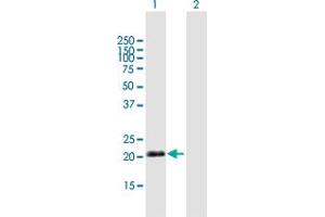 Western Blot analysis of IGJ expression in transfected 293T cell line by IGJ MaxPab polyclonal antibody. (IGJ Antikörper  (AA 1-159))