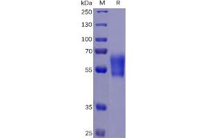Human PD-1 Protein, hFc-His Tag on SDS-PAGE under reducing condition. (PD-1 Protein (Fc-His Tag))