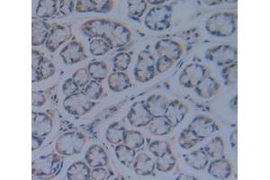 Immunohistochemistry (IHC) image for anti-Transforming Growth Factor, beta Receptor III (TGFBR3) (AA 210-465) antibody (ABIN1860735)