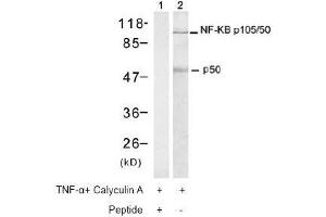 Image no. 2 for anti-Nuclear Factor of kappa Light Polypeptide Gene Enhancer in B-Cells 1 (NFKB1) (Ser337) antibody (ABIN197123) (NFKB1 Antikörper  (Ser337))