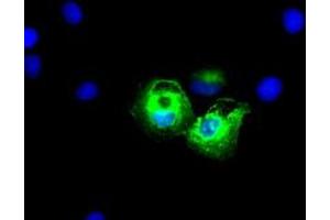 Anti-KRT8 mouse monoclonal antibody (ABIN2452349) immunofluorescent staining of COS7 cells transiently transfected by pCMV6-ENTRY KRT8 (RC209570). (KRT8 Antikörper  (AA 91-381))