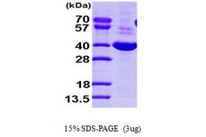 SDS-PAGE (SDS) image for Dihydrodiol Dehydrogenase (DDH) (AA 1-323) protein (His tag) (ABIN666955)
