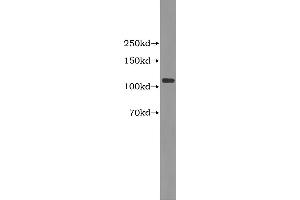 Western Blotting (WB) image for Complement Fragment 3a (C3a) ELISA Kit (ABIN1114341) (C3a ELISA Kit)