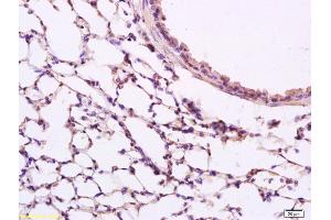 Formalin-fixed and paraffin embedded rat lung labeled with Anti phospho-Src(Tyr418) Polyclonal Antibody, Unconjugated (ABIN746153) at 1:200 followed by conjugation to the secondary antibody and DAB staining (Src Antikörper  (pTyr418))