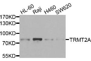 Western blot analysis of extracts of various cells, using TRMT2A antibody. (TRMT2A Antikörper)