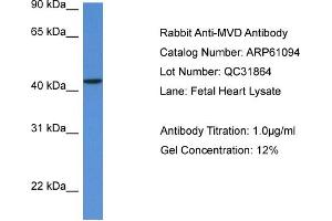Western Blotting (WB) image for anti-Mevalonate (Diphospho) Decarboxylase (MVD) (N-Term) antibody (ABIN2774304)